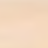 Transparent_Champagne