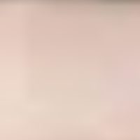 Transparent_Champagne