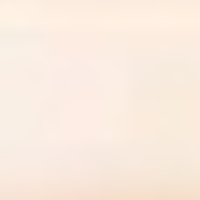 Transparent_Champagne